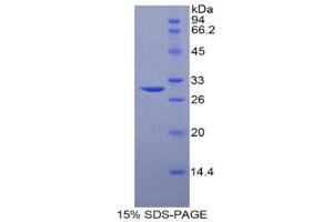 SDS-PAGE (SDS) image for Sphingosine Kinase 1 (SPHK1) (AA 148-398) protein (His tag) (ABIN1879289)