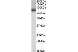 AP22452PU-N TRIM55 antibody staining of Human Heart lysate at 0. (TRIM55 antibody  (C-Term))