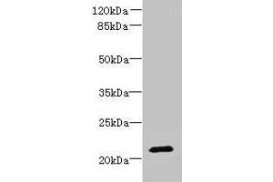 Western blot All lanes: DYDC1 antibody at 4 μg/mL + Hela whole cell lysate Secondary Goat polyclonal to rabbit IgG at 1/10000 dilution Predicted band size: 21, 22 kDa Observed band size: 21 kDa (DYDC1 antibody  (AA 1-177))