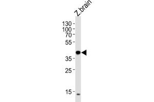 Western Blotting (WB) image for anti-Eukaryotic Translation Initiation Factor 3 Subunit E (EIF3E) antibody (ABIN3000922)