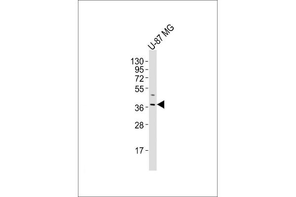 OR4K17 antibody  (AA 87-120)