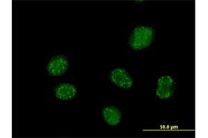 Immunofluorescence of purified MaxPab antibody to ELAC1 on HeLa cell. (ELAC1 antibody  (AA 1-363))