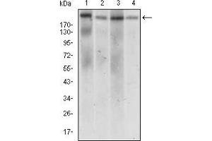 Western blot analysis using IL2RA mouse mAb against Jurkat (1), Cos7 (2), HCT116 (3) and NTERA-2 (4) cell lysate.