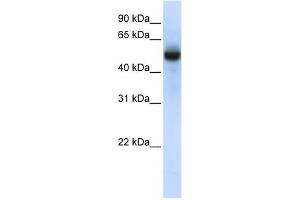 CXORF34 antibody used at 1 ug/ml to detect target protein. (TRMT2B antibody  (N-Term))