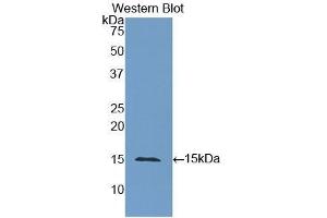 Detection of Recombinant CEA, Human using Polyclonal Antibody to Carcinoembryonic Antigen (CEA) (CEA antibody  (AA 448-572))