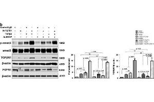 Western Blotting (WB) image for anti-SMAD, Mothers Against DPP Homolog 3 (SMAD3) (pSer423), (pSer425) antibody (ABIN129675)