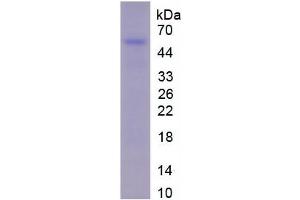 SDS-PAGE of Protein Standard from the Kit (Highly purified E. (Fibrinogen beta Chain ELISA Kit)