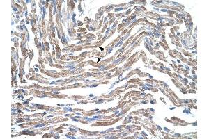 Claudin 11 antibody was used for immunohistochemistry at a concentration of 4-8 ug/ml to stain Skeletal muscle cells (arrows) in Human Muscle.