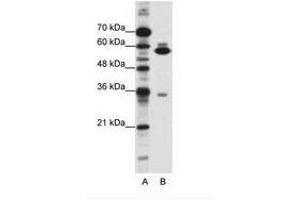 Image no. 1 for anti-Zinc Finger Protein 446 (ZNF446) (C-Term) antibody (ABIN202554) (ZNF446 antibody  (C-Term))