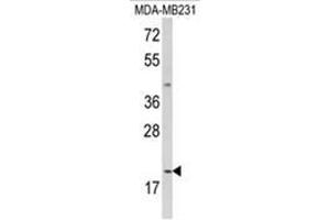 Western blot analysis of IL12A Antibody (C-term) in MDA-MB231 cell line lysates (35ug/lane). (IL12A antibody  (C-Term))