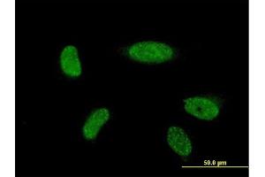 Immunofluorescence of monoclonal antibody to ATOH1 on HeLa cell. (ATOH1 antibody  (AA 266-354))