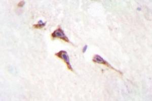 Image no. 2 for anti-Mechanistic Target of Rapamycin (serine/threonine Kinase) (mTOR) antibody (ABIN272127) (MTOR antibody)