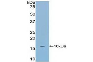 Detection of Recombinant TPS, Mouse using Polyclonal Antibody to Tryptase (TPS) (TPSAB1 antibody  (AA 149-273))