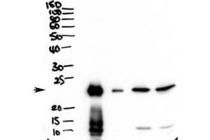 Western blot testing of secretions from human primary airway cells in culture (lanes 1 and 2) and in human bronchoalveolar lavage fluid (lanes 3 and 4) with PLUNC antibody at 2ug/ml. (BPIFA1 antibody)