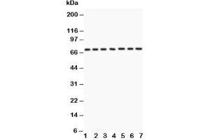 Western blot testing of Lamin A antibody and Lane 1:  human placenta;  2: SKOV;  3: SW620;  4: COLO320;  5: HeLa;  6: 293T;  7: A549 lysate (Lamin A/C antibody  (AA 481-646))