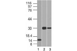 Western blot of 1) partial recombinant protein, 2) Panc-28 and 3) PANC1 cell lysate using CELA3B antibody (CELA3B/1218). (Elastase 3B antibody  (AA 82-238))