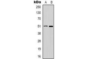 Western blot analysis of GABRD expression in HT29 (A), PC12 (B) whole cell lysates. (GABRD antibody)