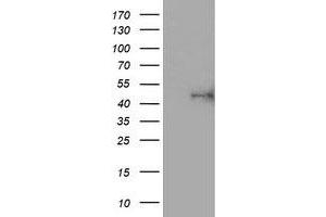 HEK293T cells were transfected with the pCMV6-ENTRY control (Left lane) or pCMV6-ENTRY ALG2 (Right lane) cDNA for 48 hrs and lysed. (ALG2 antibody)