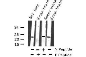 Western blot analysis of Phospho-RhoA (Ser188) expression in various lysates (RHOA antibody  (pSer188))