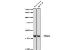 Western blot analysis of extracts of various cell lines, using HMGCS2 antibody (ABIN7265328) at 1:1000 dilution. (HMGCS2 antibody)
