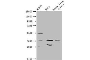 Western blot All lanes: MRGPRX2 antibody at 5 μg/mL Lane 1: 293T whole cell lysate Lane 2: Mouse liver tissue Secondary Goat polyclonal to rabbit IgG at 1/10000 dilution Predicted band size: 38 kDa Observed band size: 38 kDa (MRGPRX2 antibody  (AA 286-330))