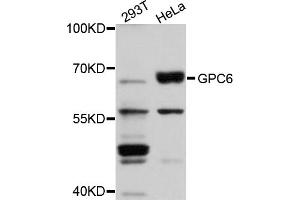 Western blot analysis of extracts of various cell lines, using GPC6 antibody (ABIN5974717) at 1/1000 dilution. (Glypican 6 antibody)