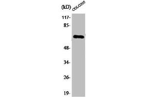 Western Blot analysis of COLO205 cells using Phospho-NFκ,B-p65 (S536) Polyclonal Antibody