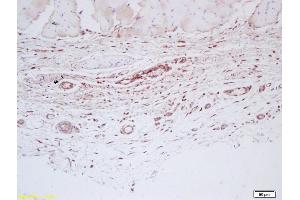Formalin-fixed and paraffin embedded human skin labeled with Anti-Factor VIII Polyclonal Antibody, Unconjugated (ABIN872493) at 1:200 followed by conjugation to the secondary antibody and DAB staining (Factor VIII antibody  (AA 85-190))