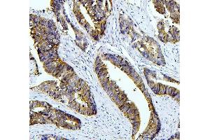 IHC analysis of TAZ using anti-TAZ antibody (ABIN7602384).