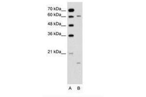 Image no. 2 for anti-Cytochrome P450, Family 4, Subfamily A, Polypeptide 22 (CYP4A22) (N-Term) antibody (ABIN6736345)