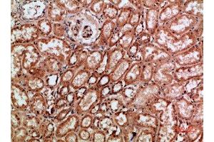 Immunohistochemical analysis of paraffin-embedded human-kidney, antibody was diluted at 1:200 (c-Rel antibody  (AA 491-540))