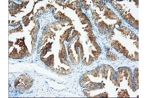 Immunohistochemical staining of paraffin-embedded Human prostate tissue using anti-XPNPEP1 mouse monoclonal antibody.
