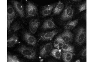 Immunofluorescence staining of A549 (Human lung carcinoma, ATCC CCL-185) cells. (Calnexin antibody  (AA 116-301))