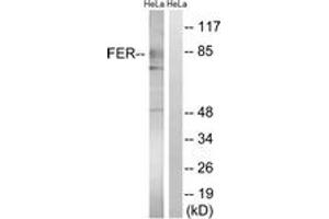 Image no. 1 for anti-FER Tyrosine Kinase (FER) (AA 371-420) antibody (ABIN2889104) (FER antibody  (AA 371-420))