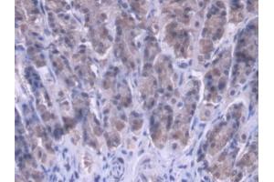 DAB staining on IHC-P; Samples: Rat Stomach Tissue (MRPL1 antibody  (AA 141-323))