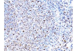 Immunohistochemistry of paraffin-embedded rat spleen using PCNA antibody (ABIN1874056) at dilution of 1:100 (40x lens). (PCNA antibody)