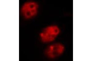 ABIN6267585 staining COS7 by IF/ICC. (MDM2 antibody  (pSer166))