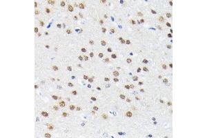 Immunohistochemistry of paraffin-embedded rat brain using Cullin 3 antibody (ABIN7266543) at dilution of 1:100 (40x lens). (Cullin 3 antibody)