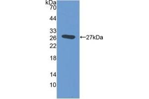 Detection of Recombinant EMILIN2, Mouse using Polyclonal Antibody to Elastin Microfibril Interface Located Protein 2 (EMILIN2)