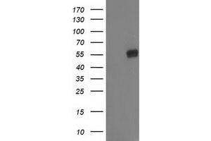 Western Blotting (WB) image for anti-Glucosidase, Beta, Acid 3 (Cytosolic) (GBA3) (AA 1-150), (AA 370-469) antibody (ABIN1490586) (GBA3 antibody  (AA 1-150, AA 370-469))