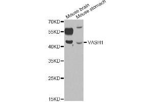 Western blot analysis of extracts of various cell lines, using VASH1 antibody (ABIN6290544) at 1:1000 dilution. (VASH1 antibody)