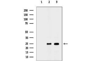 anti-Transcription Elongation Factor A (SII)-Like 8 (TCEAL8) (Internal Region) antibody
