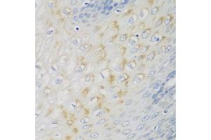 Immunohistochemistry of paraffin-embedded human esophagus using NME4 antibody at dilution of 1:100 (40x lens). (NME4 antibody)