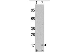 Western blot analysis of LC3 (G8a) (arrow) using purified Pab 1801b. (MAP1LC3A antibody  (AA 30-56))