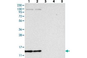 Western blot analysis of Lane 1: RT-4, Lane 2: U-251 MG, Lane 3: Human Plasma, Lane 4: Liver, Lane 5: Tonsil with SF3B14 polyclonal antibody  at 1:250-1:500 dilution. (Pre-mRNA Branch Site Protein p14 (SF3B14) antibody)