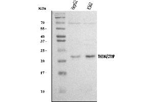 Western blot analysis of THEM4 using anti-THEM4 antibody (ABIN7599140).