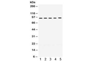 Western blot testing of human 1) A549, 2) SW620, 3) HeLa, 4) PANC, and 5) HepG2 lysate with MCM8 antibody. (MCM8 antibody)
