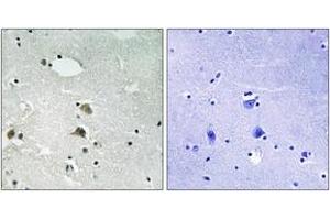 Immunohistochemistry analysis of paraffin-embedded human brain tissue, using S6 Ribosomal Protein (Ab-235/236) Antibody. (RPS6 antibody  (AA 200-249))