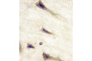 Immunohistochemical staining of formalin-fixed and paraffin-embedded human brain tissue reacted with EPHA5 monoclonal antibody  at 1:10-1:50 dilution.