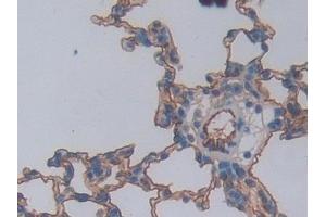 Immunohistochemistry (IHC) image for anti-Intercellular Adhesion Molecule 1 (ICAM1) (AA 102-306) antibody (ABIN7431977)